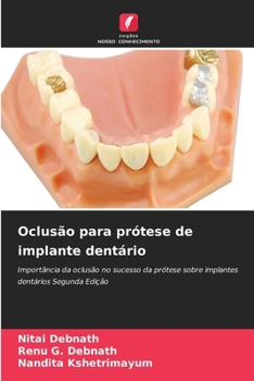 Oclusão para prótese de implante dentário (Portuguese Edition)
