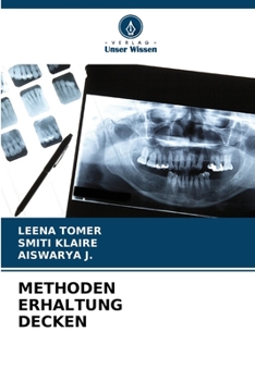 Paperback Methoden Erhaltung Decken [German] Book