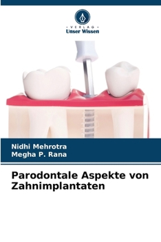 Paperback Parodontale Aspekte von Zahnimplantaten [German] Book