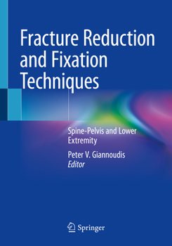 Paperback Fracture Reduction and Fixation Techniques: Spine-Pelvis and Lower Extremity Book
