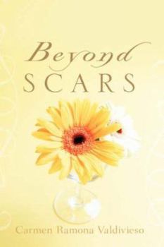 Paperback Beyond Scars Book