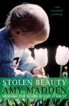 Paperback Stolen Beauty: Healing the Scars of Child Abuse: One Woman's Journey Book