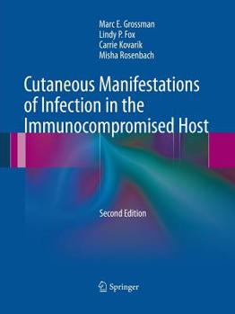 Paperback Cutaneous Manifestations of Infection in the Immunocompromised Host Book