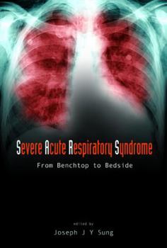 Hardcover Severe Acute Respiratory Syndrome (Sars): From Benchtop to Bedside Book