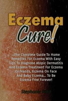 Paperback Eczema Cure!: The Complete Guide to Home Remedies for Eczema With Easy Tips to D Book