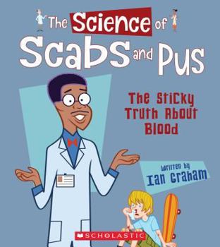 The Science of Scabs and Pus: The Sticky Truth About Blood (The Science of the Body)