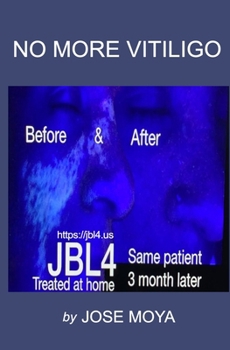 Paperback No More Vitiligo Book