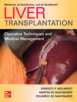 Hardcover Liver Transplantation: Operative Techniques and Medical Management Book