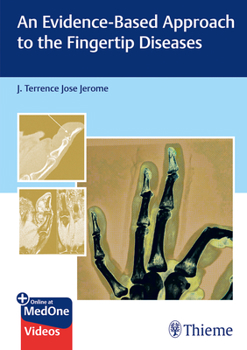 Hardcover An Evidence-Based Approach to the Fingertip Diseases Book