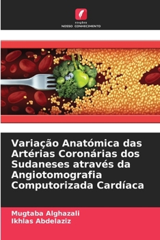 Paperback Variação Anatómica das Artérias Coronárias dos Sudaneses através da Angiotomografia Computorizada Cardíaca [Portuguese] Book