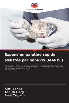 Expansion palatine rapide assistée par mini-vis (MARPE) (French Edition)