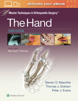 Hardcover Master Techniques in Orthopaedic Surgery: The Hand Book