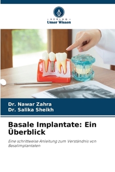 Paperback Basale Implantate: Ein Überblick [German] Book