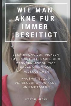 Paperback Wie Man Akne Für Immer Beseitigt: Bekämpfung Von Pickeln Im Gesicht Bei Frauen Und Männern, Endgültige Behandlung Von Jugendlichen Hausmittel Zur Vorb [German] Book