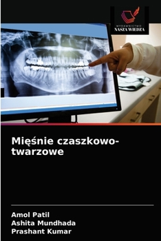 Paperback Mi&#281;&#347;nie czaszkowo-twarzowe [Polish] Book