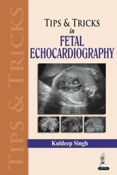 Paperback Tips & Tricks in Fetal Echocardiography Book