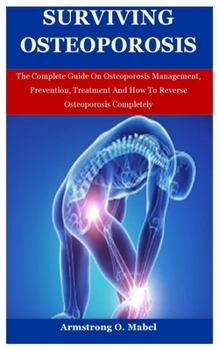 Paperback Surviving Oteoporosis: The Complete Guide On Osteoporosis Management, Prevention, Treatment And How To Reverse Osteoporosis Completely Book