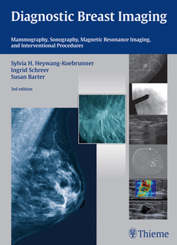 Hardcover Diagnostic Breast Imaging: Mammography, Sonography, MRI and Interventional Procedures Book