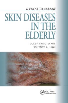 Paperback Skin Diseases in the Elderly: A Color Handbook Book