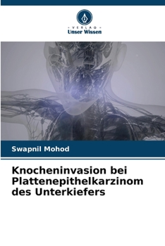 Paperback Knocheninvasion bei Plattenepithelkarzinom des Unterkiefers [German] Book