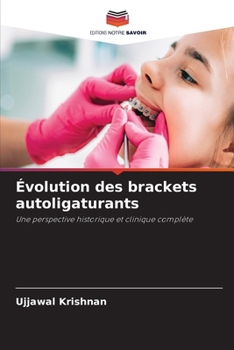 Évolution des brackets autoligaturants (French Edition)