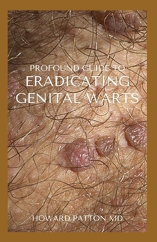 Paperback Profound Guide to Eradicating Genital Warts: The Effective Guide To Help You Destroy Your Existing Warts Book