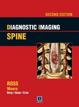 Hardcover Diagnostic Imaging: Spine Book