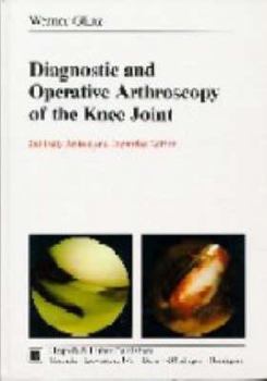 Diagnostic and Operative Arthroscopy of the Knee Joint