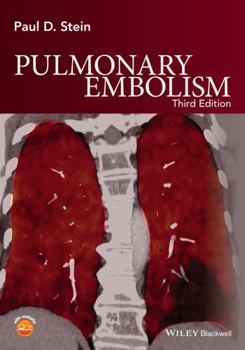 Hardcover Pulmonary Embolism Book