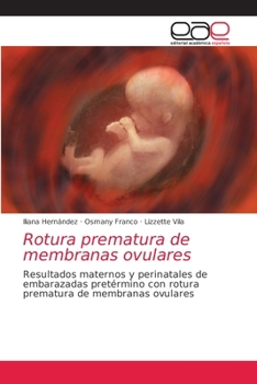 Paperback Rotura prematura de membranas ovulares [Spanish] Book