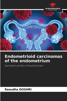 Paperback Endometrioid carcinomas of the endometrium Book