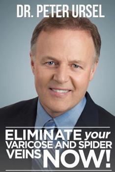 Paperback Eliminate Your Varicose and Spider Veins Now Book