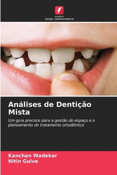 Análises de Dentição Mista (Portuguese Edition)