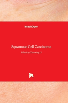 Hardcover Squamous Cell Carcinoma Book