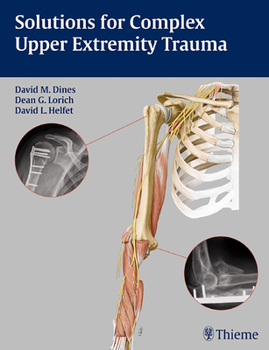 Hardcover Solutions for Complex Upper Extremity Trauma Book
