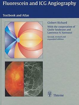 Hardcover Fluorescein and ICG Angiography: Textbook and Atlas Book