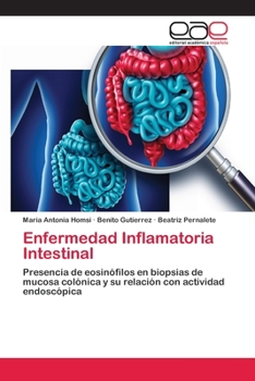 Paperback Enfermedad Inflamatoria Intestinal [Spanish] Book