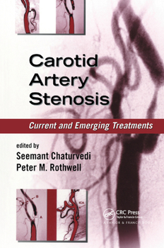 Paperback Carotid Artery Stenosis: Current and Emerging Treatments Book
