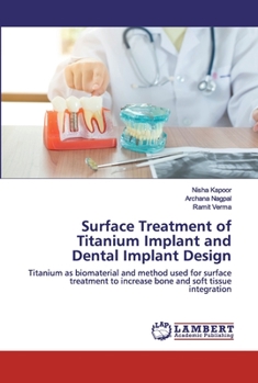 Paperback Surface Treatment of Titanium Implant and Dental Implant Design Book