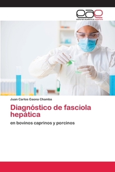 Paperback Diagnóstico de fasciola hepática [Spanish] Book