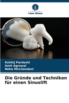Paperback Die Gründe und Techniken für einen Sinuslift [German] Book