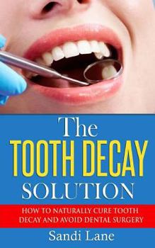 Paperback The Tooth Decay Solution: How to Naturally Cure Tooth Decay and Avoid Dental Surgery Book