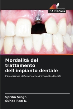 Paperback Mordalità del trattamento dell'impianto dentale [Italian] Book
