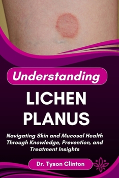 Paperback Understanding Lichen Planus: Navigating Skin and Mucosal Health through Knowledge, Prevention, and Treatment Insights Book
