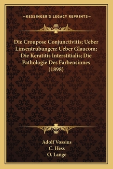 Paperback Die Croupose Conjunctivitis; Ueber Linsentrubungen; Ueber Glaucom; Die Keratitis Interstitialis; Die Pathologie Des Farbensinnes (1898) [German] Book