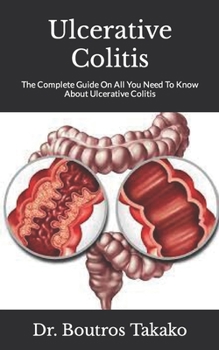 Paperback Ulcerative Colitis: The Complete Guide On All You Need To Know About Ulcerative Colitis Book