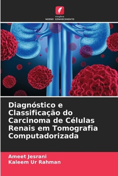 Paperback Diagnóstico e Classificação do Carcinoma de Células Renais em Tomografia Computadorizada [Portuguese] Book