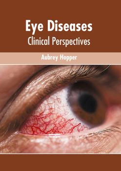 Hardcover Eye Diseases: Clinical Perspectives Book