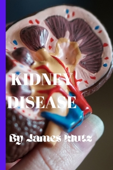 Paperback Kidney disease [Large Print] Book
