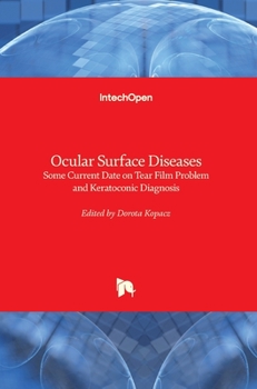 Hardcover Ocular Surface Diseases: Some Current Date on Tear Film Problem and Keratoconic Diagnosis Book